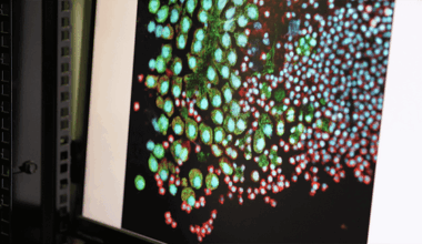 [Vidéo] Décoder la lumière cachée des tissus vivants | ECHOSCIENCES