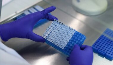 Isère. La fondation UGA se tourne vers le grand public pour financer la recherche contre la sarcoïdose