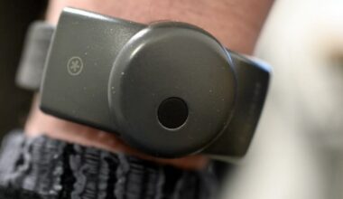 Grand Nancy. Visage tuméfié, côtes cassées... Un nourrisson hospitalisé 17 jours après sa naissance, son père condamné pour violences