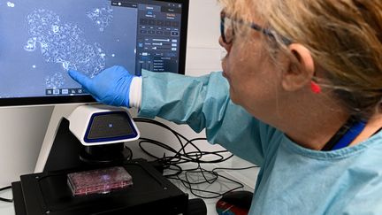 Maryvonne Ardourel, docteure en microbiologie, pointe du doigt des cellules cancéreuses sur un écran d'un laboratoire de l'Inserm à Orléans (Loiret), le 18 novembre 2025. (JEAN-FRANCOIS MONIER / AFP)
