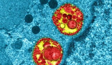 Deux cas de coronavirus MERS détectés en France : on en sait plus sur les deux personnes contaminées