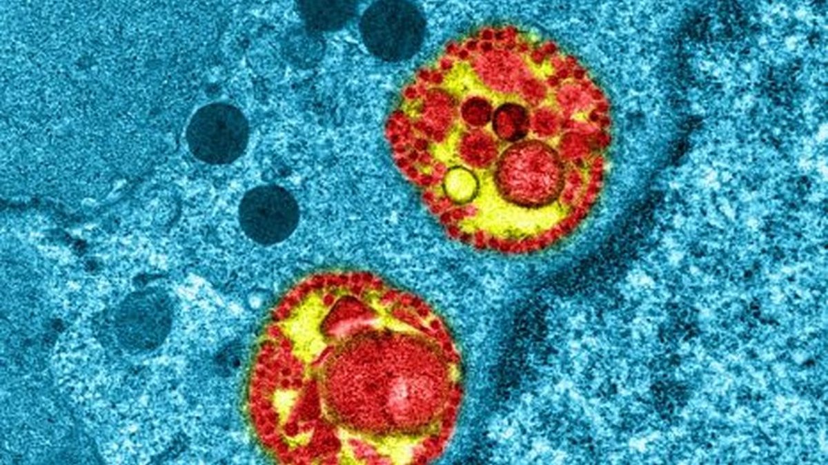 Deux cas de coronavirus MERS détectés en France : on en sait plus sur les deux personnes contaminées
