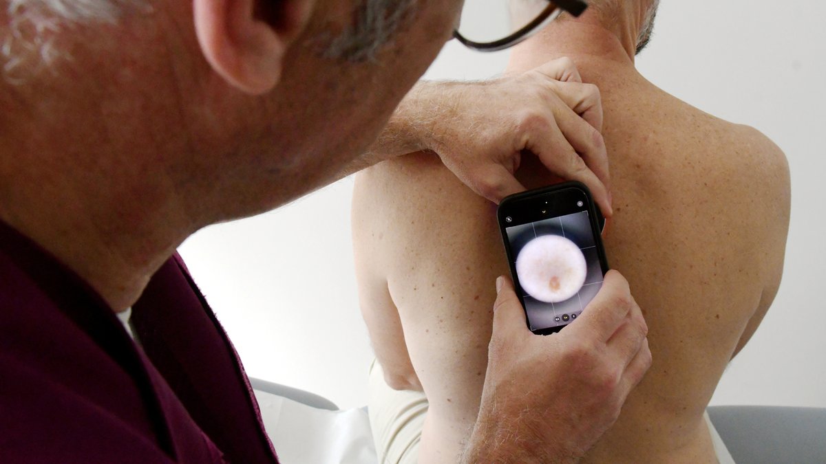 "Moins 30 % de dermatologues en 2030" : la profession, au bord de la rupture, lance une pétition nationale sur cette pénurie alarmante