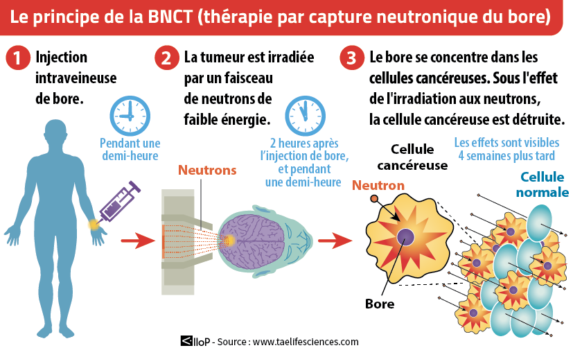 BNCT : comment ça marche.