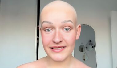 “On m'a annoncé que j'avais un cancer rare de la bouche, voici les 3 symptômes que j'ai eus avant d'être diagnostiquée”