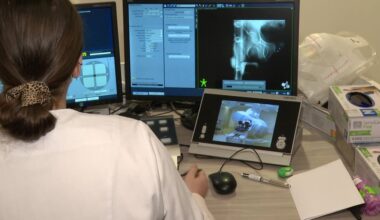 qu'est-ce que la radiothérapie stéréotaxique, cette méthode innovante qui soigne les cancers masculins ?