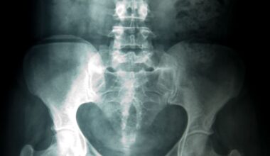 A Paris, un centre de radiologie au cœur d’accusations de violences sexuelles – Libération