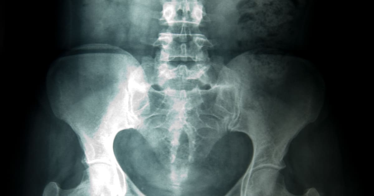 A Paris, un centre de radiologie au cœur d’accusations de violences sexuelles – Libération