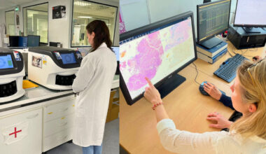 le diagnostic du cancer amélioré grâce à cette innovation