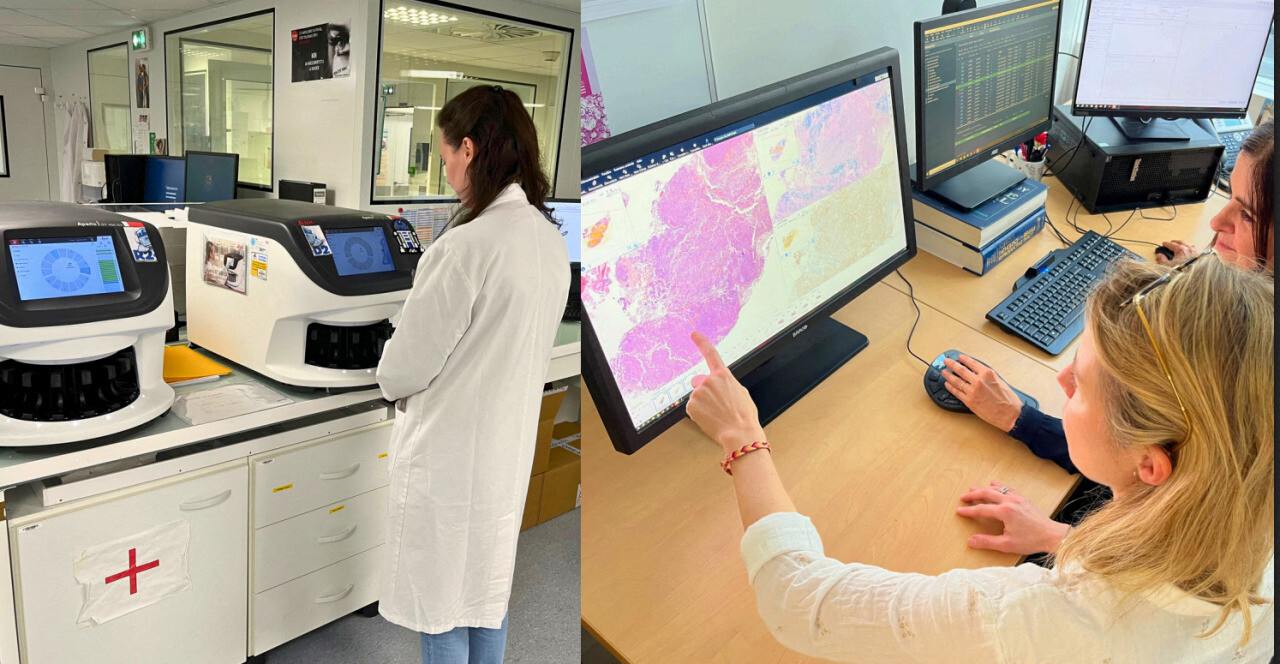 le diagnostic du cancer amélioré grâce à cette innovation