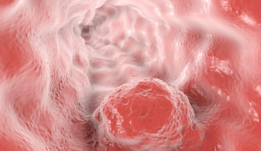 Ce symptôme banal qui peut cacher un cancer de l’œsophage silencieux