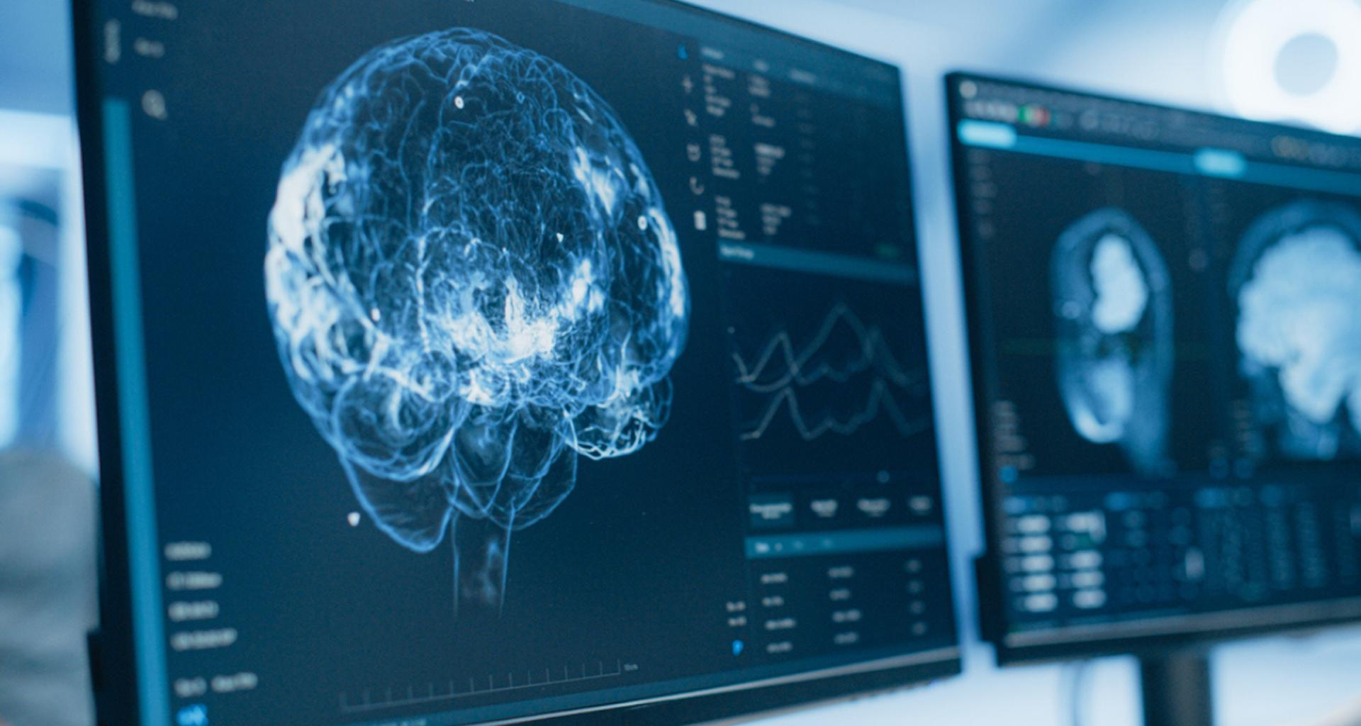 ce dérèglement nocturne caché commence bien avant les pertes de mémoire