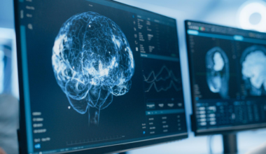 ce dérèglement nocturne caché commence bien avant les pertes de mémoire