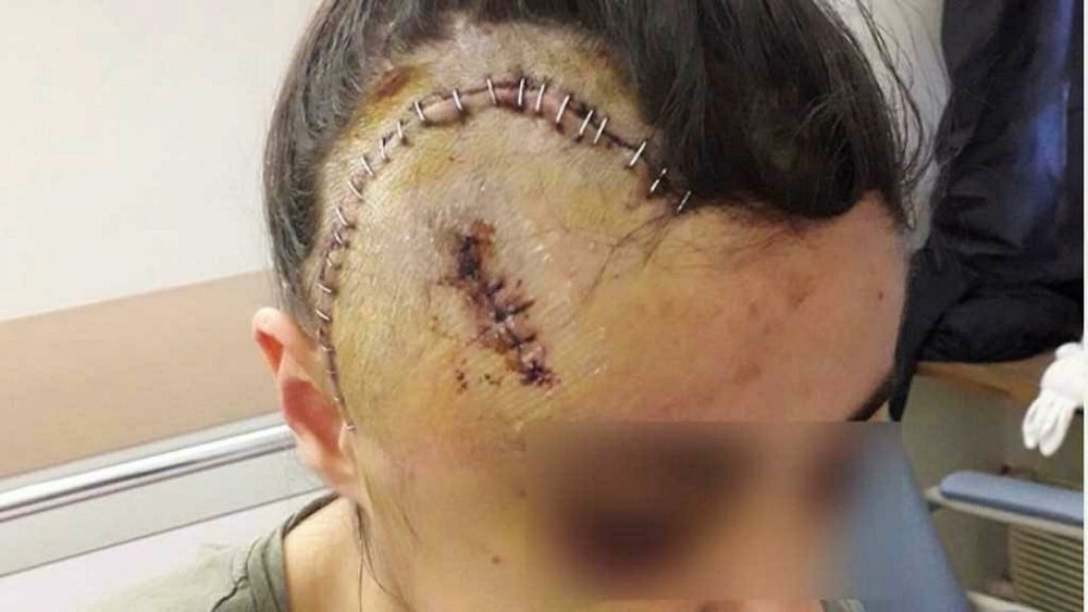 Un ancien policier de la BAC Nord mis en examen pour le passage à tabac de Maria à Marseille