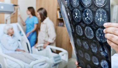 Hypercholest%c3%a9rol%c3%a9mie Familiale Une D%c3%a9couverte G%c3%a9n%c3%a9tique Fran%c3%a7aise Ouvre La Voie %c3%a0 Des Traitements Sur Mesure Pour %c3%a9viter Les Avc Pr%c3%a9coces