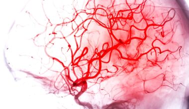 cerveau d&eacute;mence