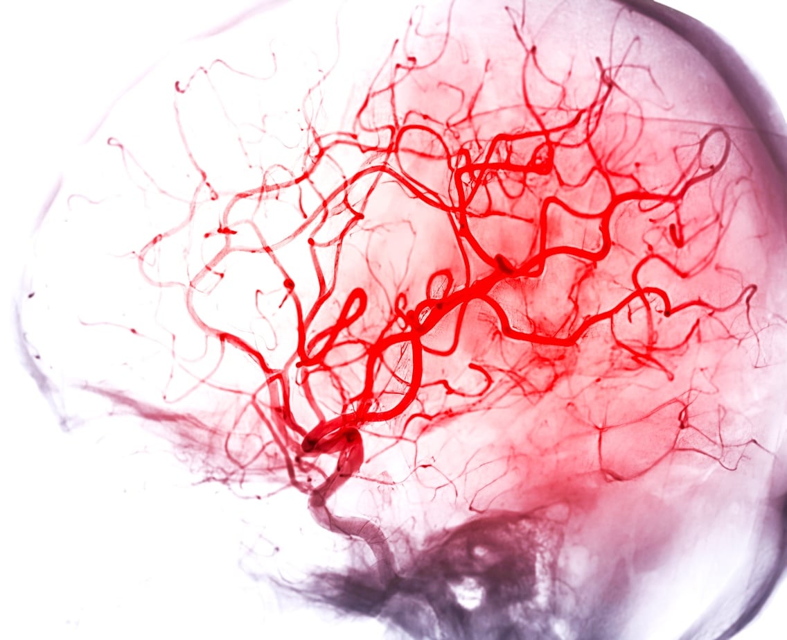 cerveau d&eacute;mence