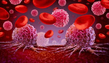 Un allié inattendu pourrait devenir l'arme secrète contre certains cancers du sang parmi les plus tenaces