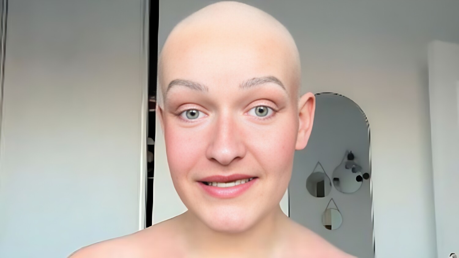 Justine, 25 ans : “On m'a annoncé que j'avais un cancer rare de la bouche, voici les 3 symptômes que j'ai eus avant d'être diagnostiquée”