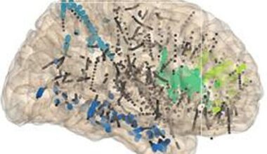Une signature neuronale de la conscience perceptive | ECHOSCIENCES