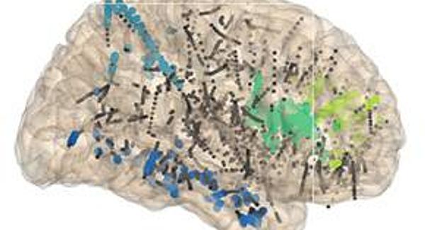 Une signature neuronale de la conscience perceptive | ECHOSCIENCES