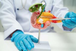 [Série 3/3] Cancer du pancréas, une augmentation importante inexpliquée