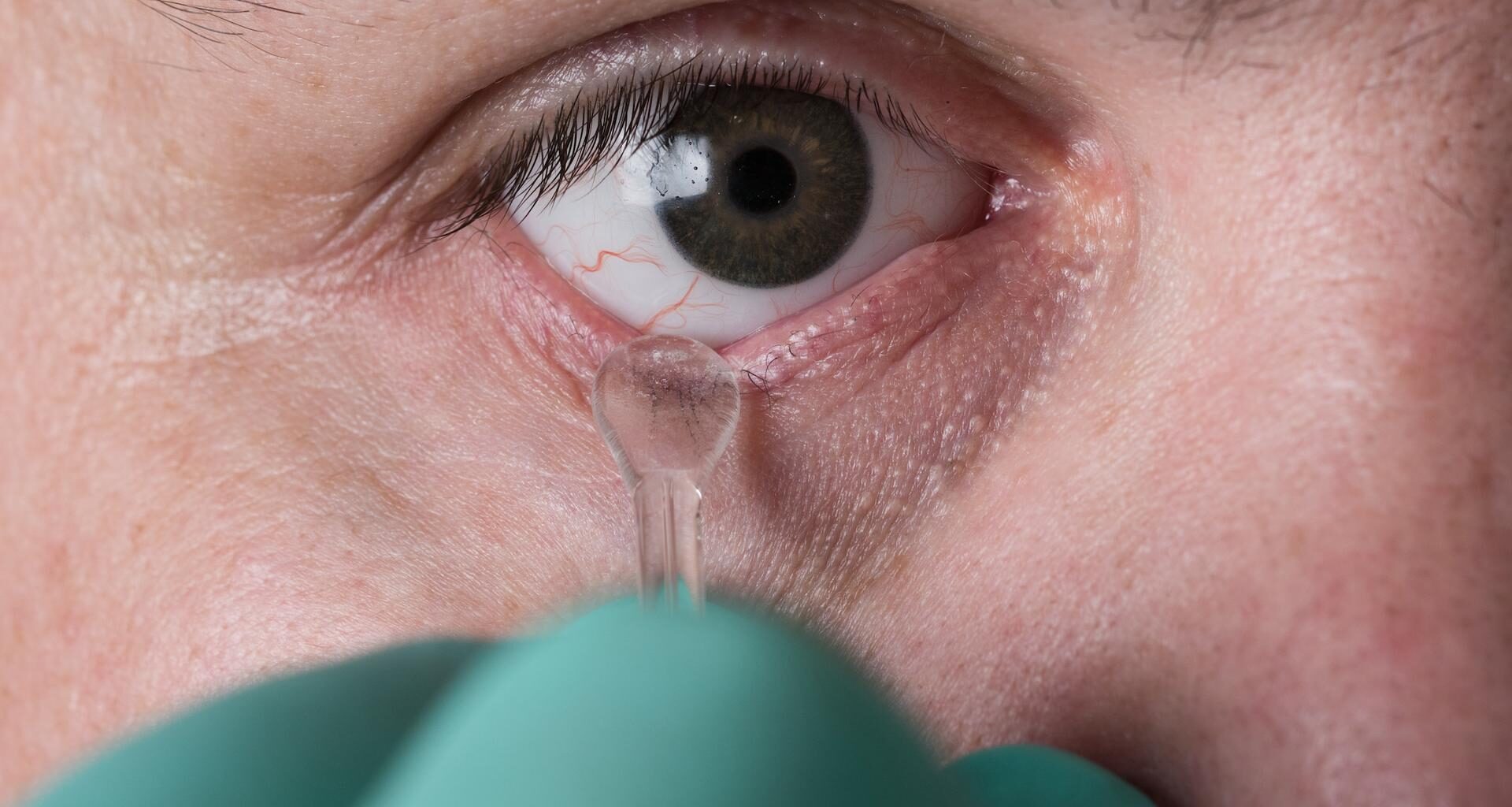 il recouvre la vue après qu’on lui a greffé un morceau de sa mâchoire dans l'œil