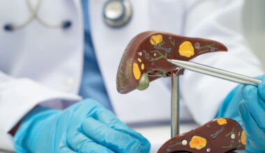 une pandémie méconnue des Français