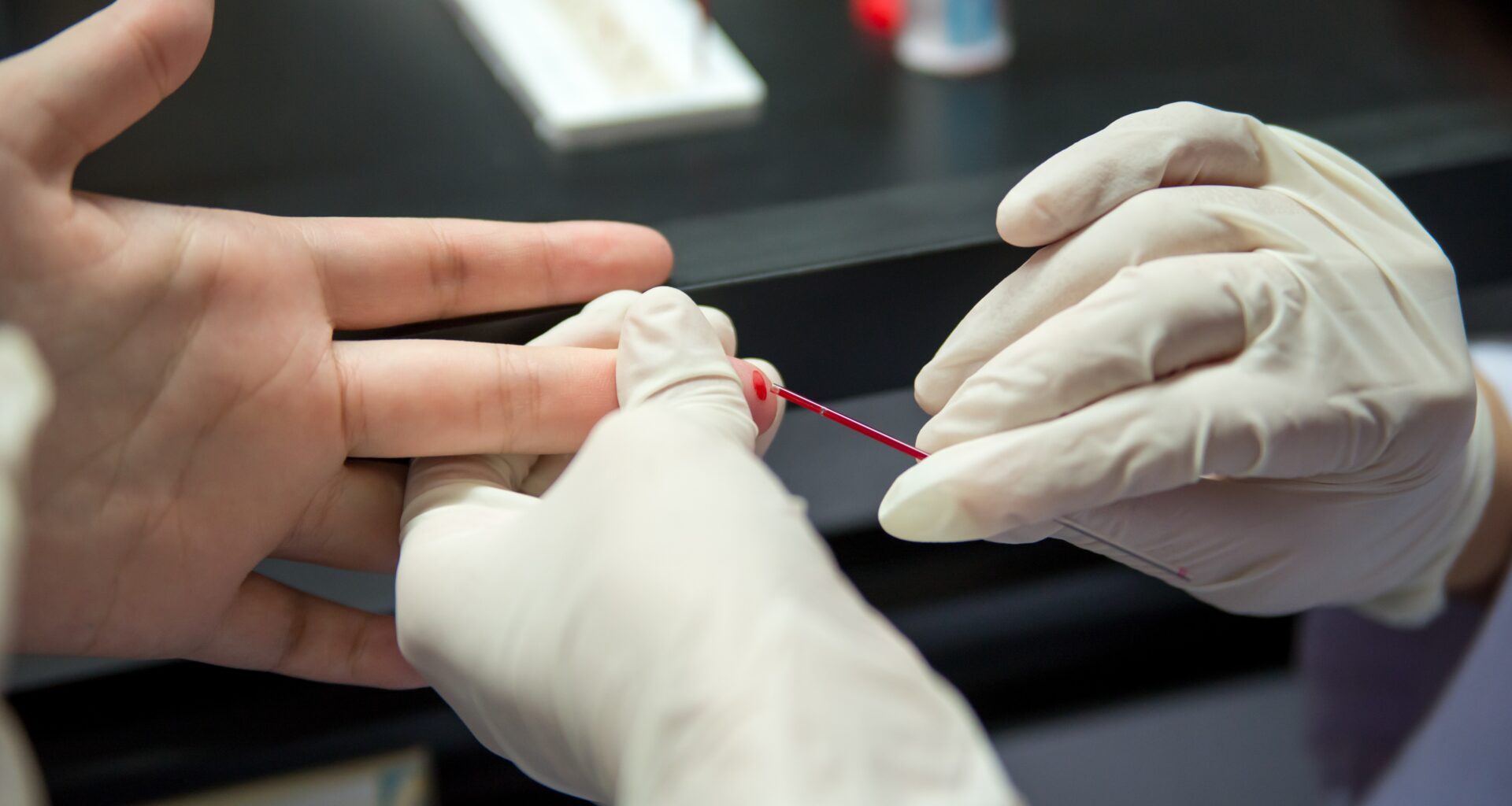 ce virus touche près de 4000 personnes sans qu'elles le sachent, l'ARS renforce ses actions