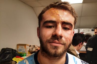 Le rugbyman gersois Valentin Muradore arbore une impressionnante balafre qui lui barre le front.