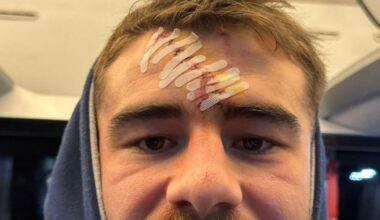 "En pleine carafe" : défiguré par un crampon, ce rugbyman recousu par une spectatrice gynécologue !