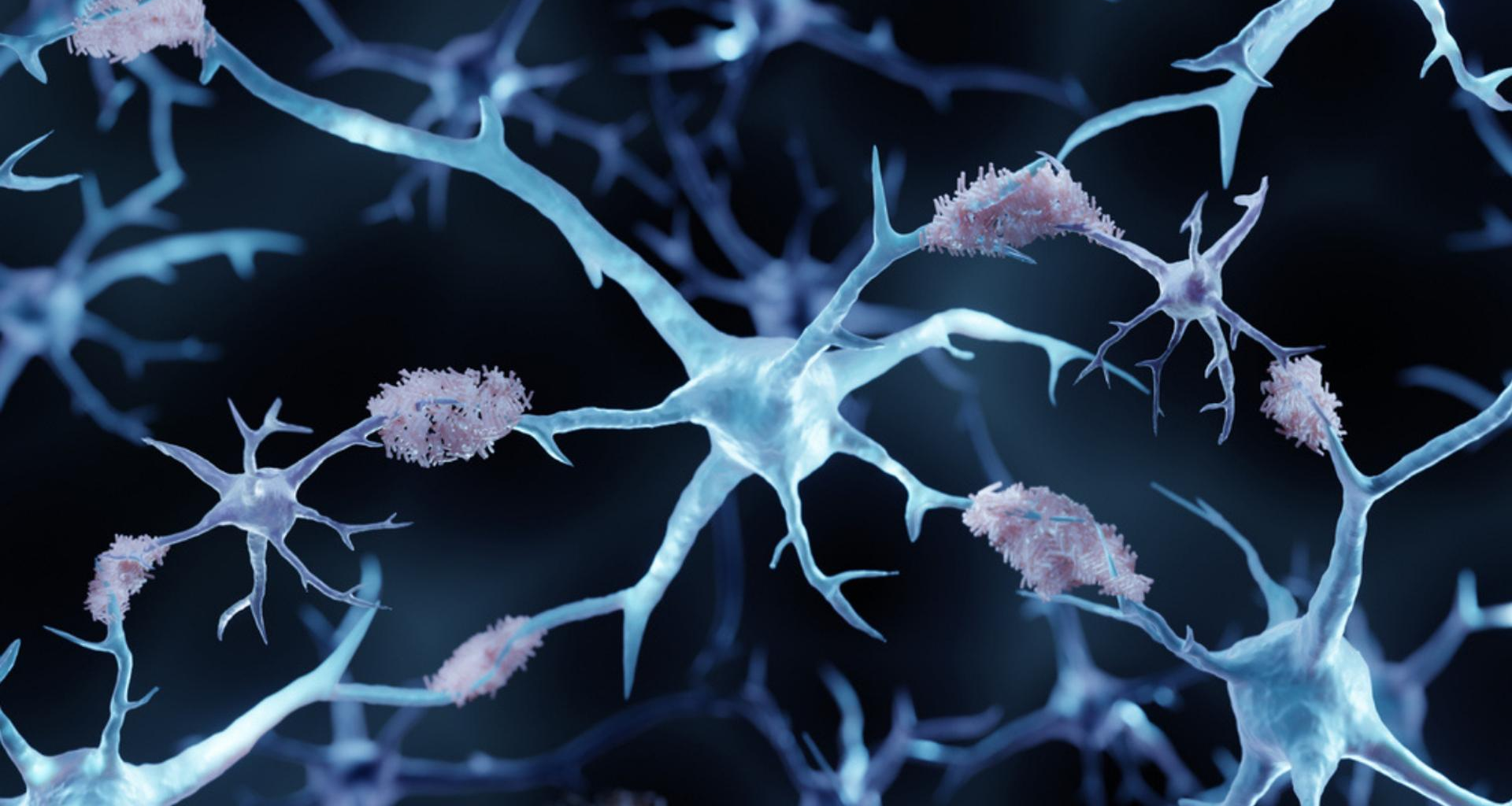 ce nouveau coupable qui pourrait changer notre compréhension de la maladie