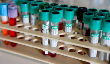 un cardiologue déconseille catégoriquement cet aliment avant une prise de sang