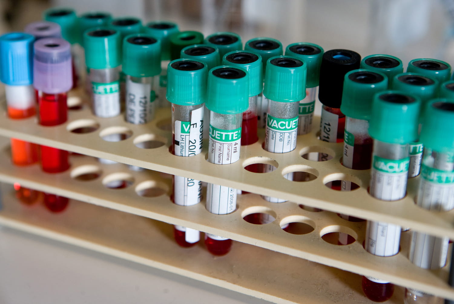 un cardiologue déconseille catégoriquement cet aliment avant une prise de sang