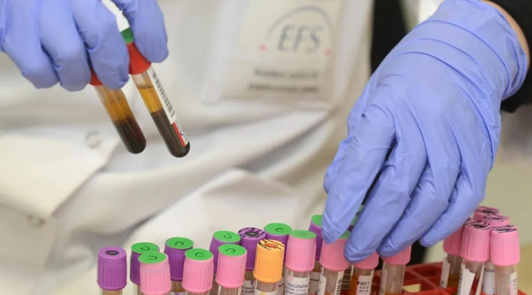 160 rendez-vous supplémentaires à Nantes pour faciliter le don de plasma