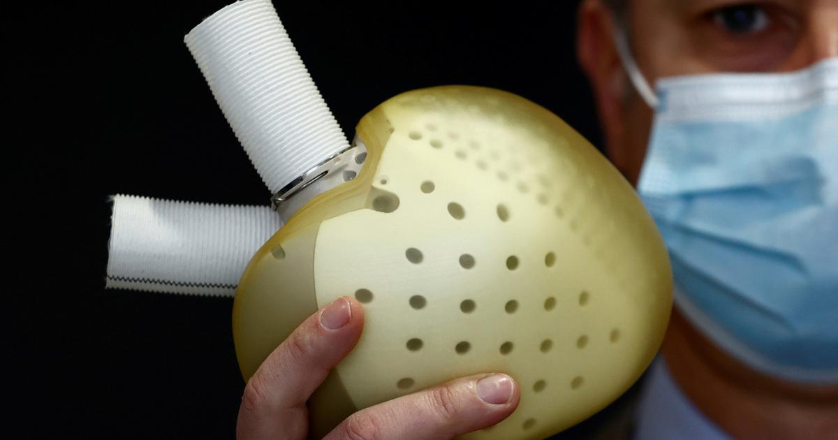 La société Carmat liquidée, nouvelle étape pour le spécialiste du coeur artificiel