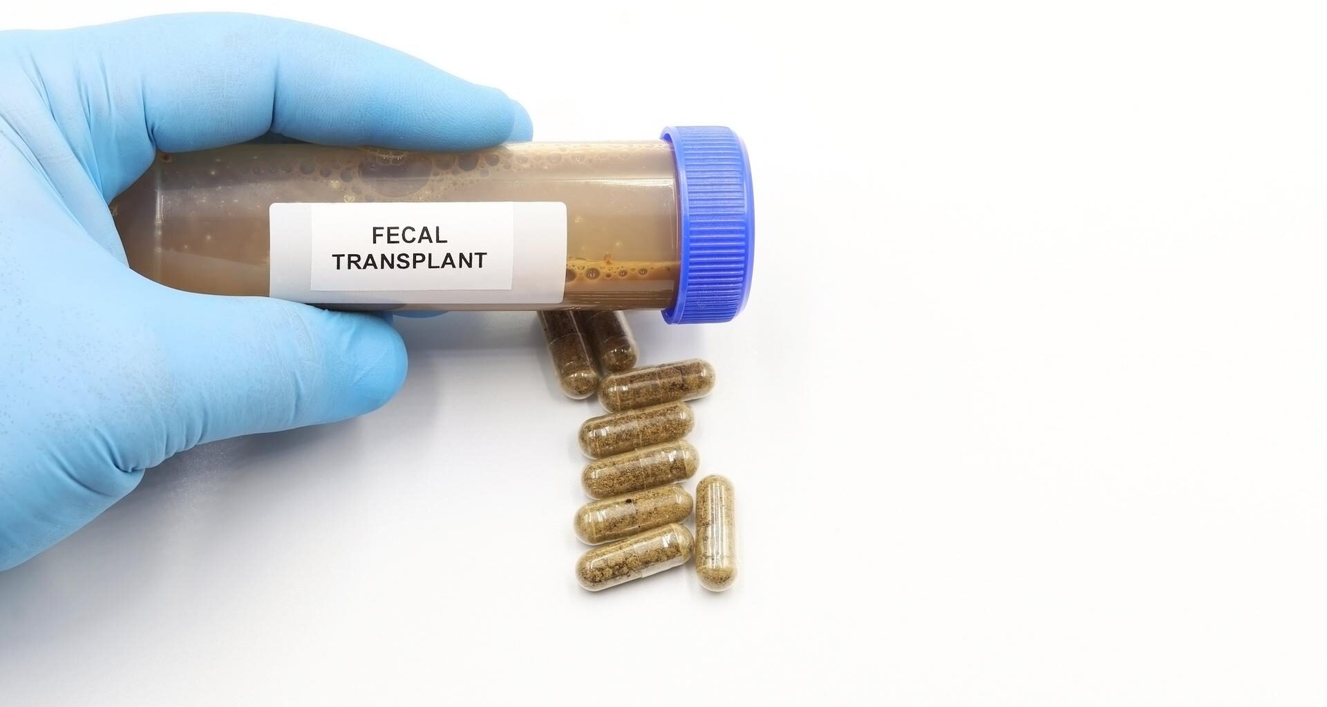 la transplantation de microbiote fécal donne des résultats inattendus pour les traitements