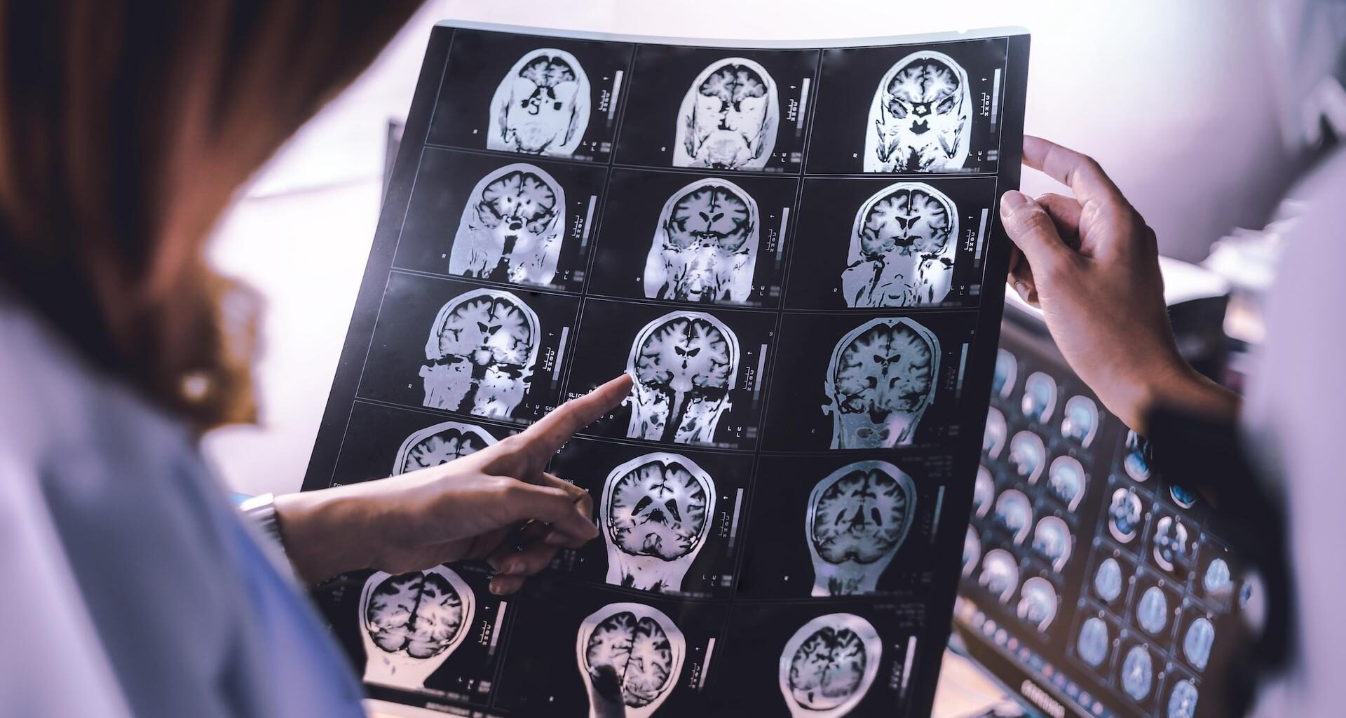 une récupération du cerveau jugée impossible vient d’être observée