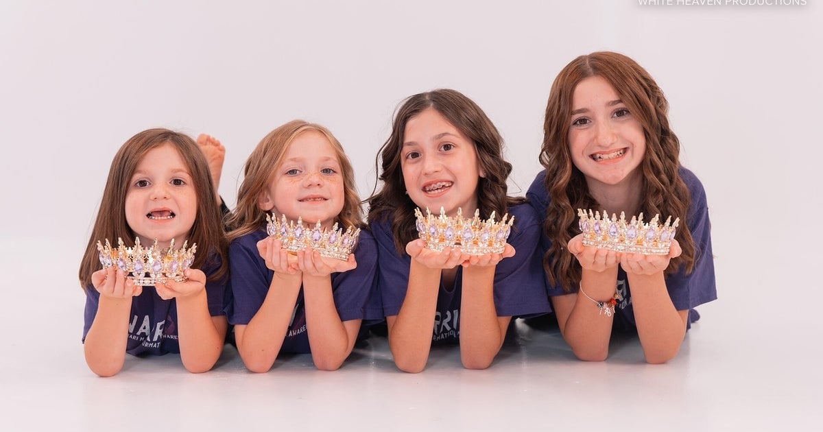 "Extrêmement rare" : quatre sœurs de 4, 6, 9 et 12 ans atteintes de la même maladie cérébrale pouvant entraîner la paralysie