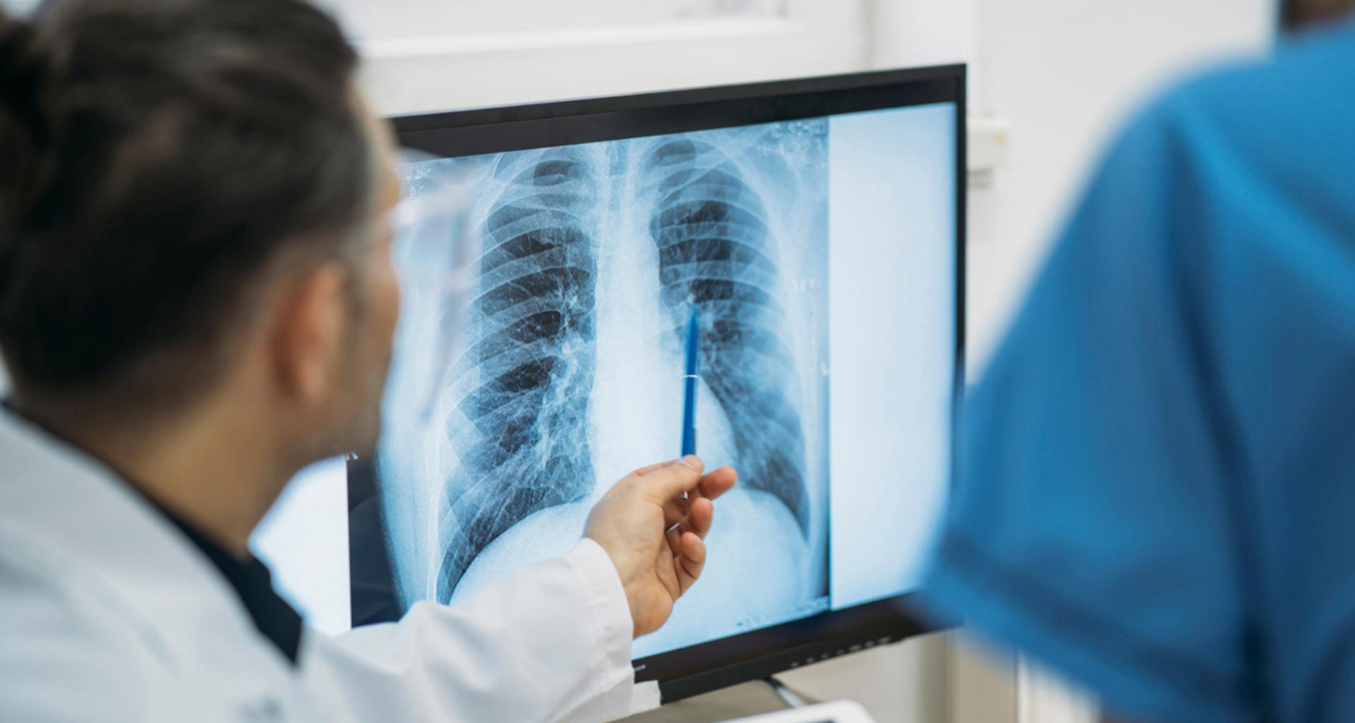 Greffe du futur ? Un homme survit 100 jours avec un cœur artificiel