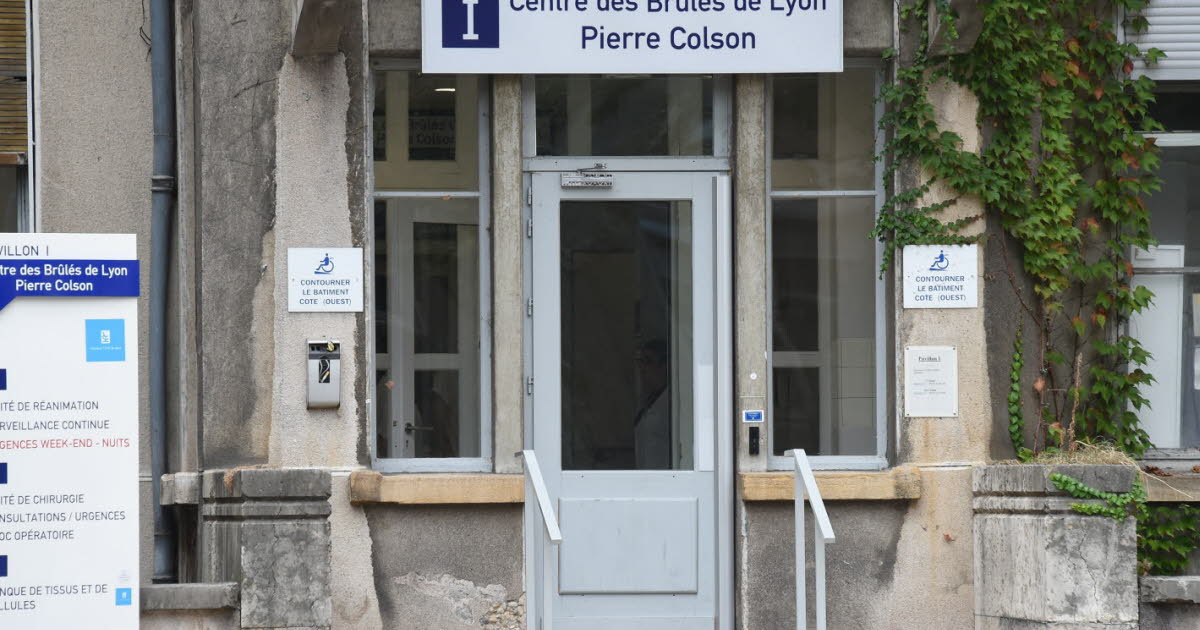 au centre des brûlés de Lyon, l’urgence et l’après