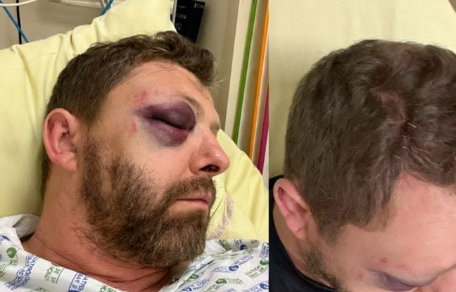 Homophobie : « Sale pédé »… Un policier, président d’une association LGBT+, violemment agressé à Paris