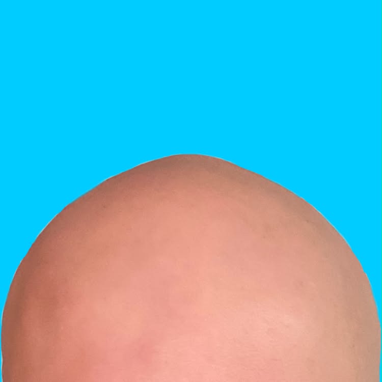 World's Biggest Bald Gathering Happening This Weekend at Görlitzer Park