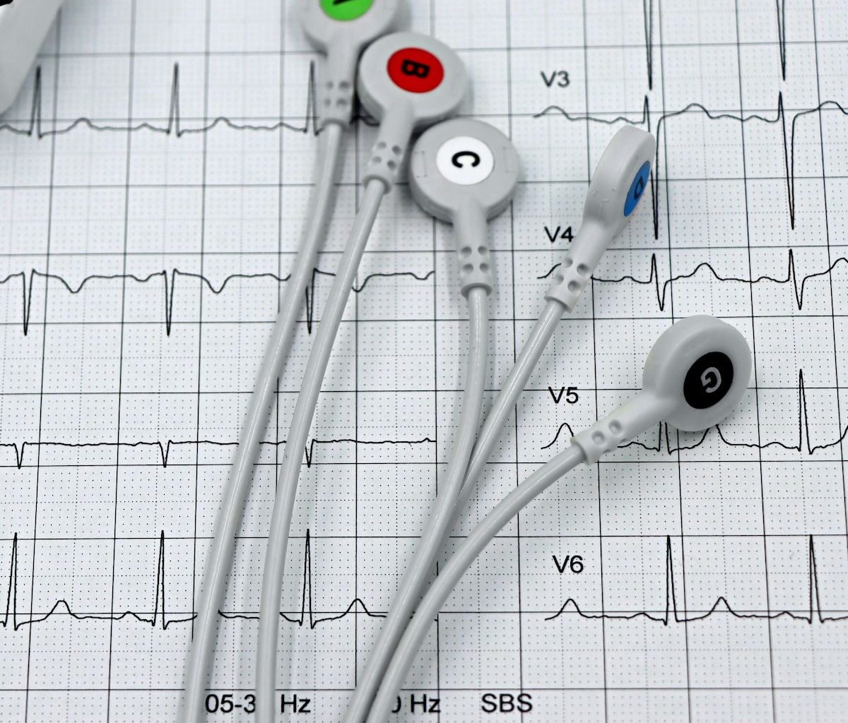 Liver Stiffness and Fat Content May Lead to Coronary Heart Disease, Study Suggests