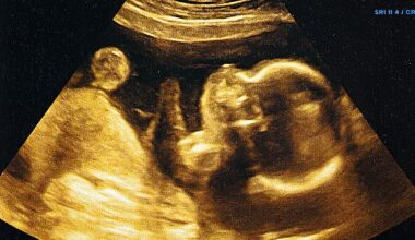 Using artificial intelligence to analyse ultrasound scans could give parents the exact day their child will be born with 95 per cent accuracy, a study has claimed