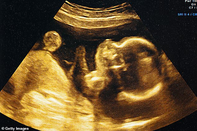 Using artificial intelligence to analyse ultrasound scans could give parents the exact day their child will be born with 95 per cent accuracy, a study has claimed