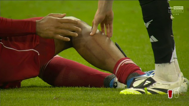 Van Dijk was left with visible stud marks on his leg following the tackle from Gordon