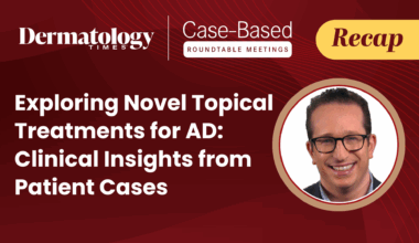 Navigating a New Era of AD Treatment Options