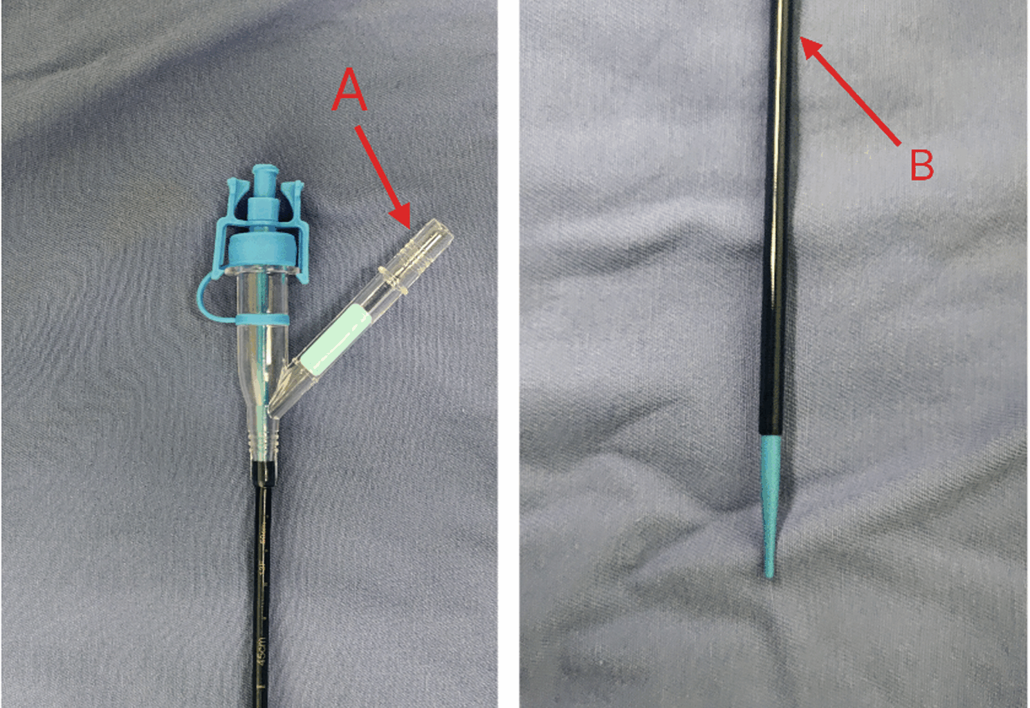 Safety and efficacy of flexible and navigable suction combined with retrograde flexible ureteroscopy in the management of infectious stones | BMC Infectious Diseases