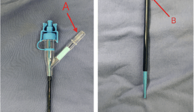 Safety and efficacy of flexible and navigable suction combined with retrograde flexible ureteroscopy in the management of infectious stones | BMC Infectious Diseases